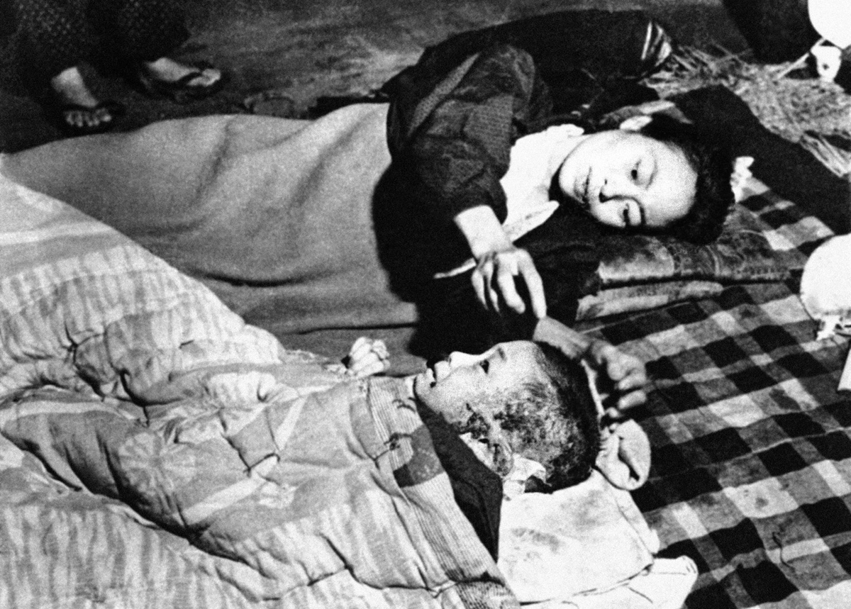 Japan Hiroshima Atom Bomb Victims